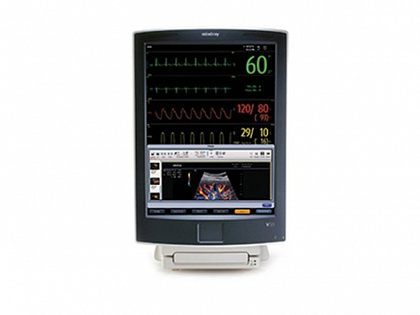 Монитор пациента Mindray V21