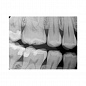 Carestream Dental RVG 6200 - радиовизиограф, 24 пар линий/мм