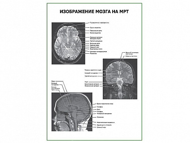 Изображение мозга на МРТ плакат глянцевый А1/А2 (глянцевый A1)