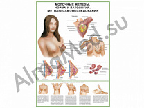 Молочные железы, мастопатия, самообследование, плакат глянцевый/ламинированный А1/А2 (глянцевый A2)