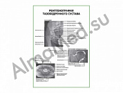 Рентгенография тазобедренного сустава плакат глянцевый/ламинированный А1/А2 (глянцевый	A2)