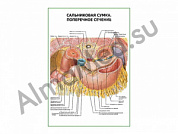 Сальниковая сумка. Поперечное сечение плакат ламинированный А1/А2 (ламинированный	A2)