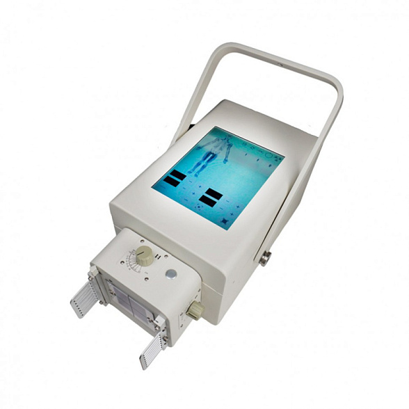 Портативный рентген DS.Xray 10010t