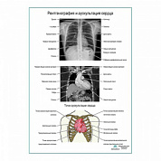 Рентгенография и аускультация сердца плакат глянцевый  А1+/А2+ (глянцевая фотобумага от 200 г/кв.м, размер A1+)