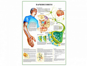 Паркинсонизм плакат глянцевый А1/А2 (глянцевый A2)