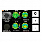 Анализатор волнового фронта KR-1W, Topcon