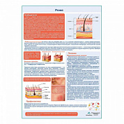 Рожа медицинский плакат А1+/A2+ (матовый холст от 200 г/кв.м, размер A1+)