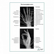 Рентгенография кисти плакат глянцевый А1+/А2+ (матовый холст от 200 г/кв.м, размер A1+)