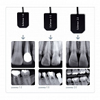 Vatech EzSensor - цифровой радиовизиограф