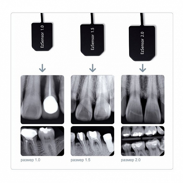 Vatech EzSensor - цифровой радиовизиограф