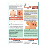 Розовый лишай (Жибера) медицинский плакат А1+/A2+ (глянцевый холст от 200 г/кв.м, размер A1+)