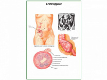 Аппендикс плакат глянцевый  А1/А2 (глянцевый A1)
