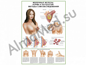 Молочные железы, мастопатия, самообследование, плакат ламинированный А1/А2 (ламинированный A2)