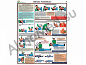 Техника реанимации, плакат ламинированный А1/А2 (ламинированный	A2)