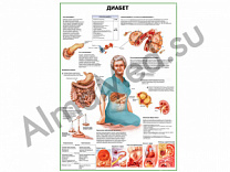 Диабет плакат глянцевый/ламинированный А1/А2 (глянцевый A2)