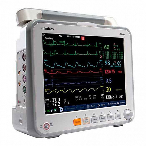 Монитор пациента Mindray iPM 12