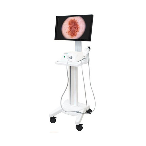 Видеодерматоскоп Dr. Camscope DCS-105 (экспертная версия), Sometech