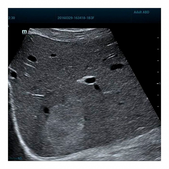 Ультразвуковая диагностическая система экспертного класса MINDRAY RESONA 6 EXP.