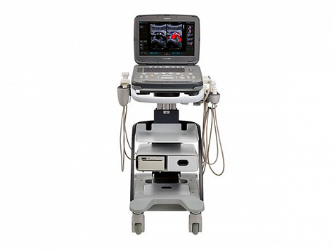 УЗИ Acuson P500 Siemens