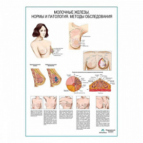 Молочные железы, мастопатия, самообследование, плакат глянцевый А1+/А2+ (глянцевый холст от 200 г/кв.м, размер A1+)