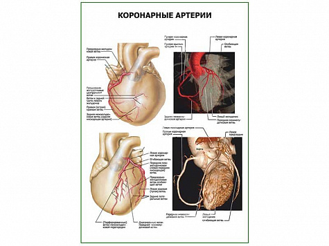 Коронарные артерии плакат глянцевый А1/А2 (глянцевый A2)