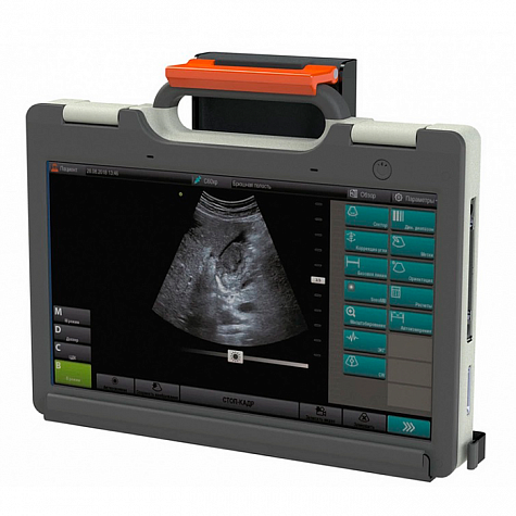 УЗИ сканер SmartScan 15
