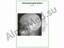 Рентгенография черепа. Вид сбоку плакат ламинированный А1/А2 (ламинированный	A2)