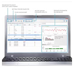 Система регистрации отоакустической эмиссии «Аудио-СМАРТ»