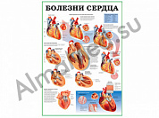 Болезни сердца, плакат глянцевый/ламинированный А1/А2 (глянцевый A2)