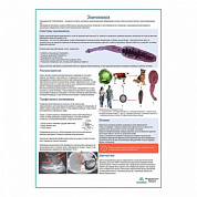 Эхинококкоз медицинский плакат А1+/A2+ (глянцевая фотобумага от 200 г/кв.м, размер A2+)