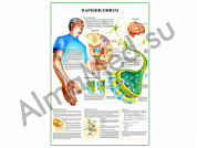 Паркинсонизм плакат глянцевый/ламинированный А1/А2 (глянцевый A2)