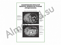 Сканирование брюшной полости: поперечное сечение (продолжение) плакат глянцевый/ламинированный А1/А2 (ламинированный	A2)