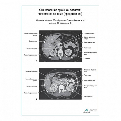 Сканирование брюшной полости: поперечное сечение (продолжение) плакат глянцевый А1+/А2+ (глянцевая фотобумага от 200 г/кв.м, размер A1+)