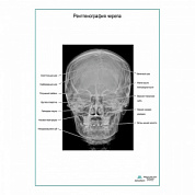 Рентгенография черепа плакат глянцевый А1+/А2+ (матовый холст от 200 г/кв.м, размер A1+)