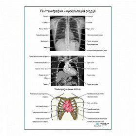 Рентгенография и аускультация сердца плакат глянцевый  А1+/А2+ (глянцевая фотобумага от 200 г/кв.м, размер A2+)