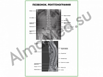 Позвонок. Рентгенография плакат глянцевый/ламинированный А1/А2 (глянцевый	A2)