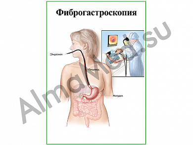 Фиброгастроскопия, плакат ламинированный А1/А2 (ламинированный	A2)