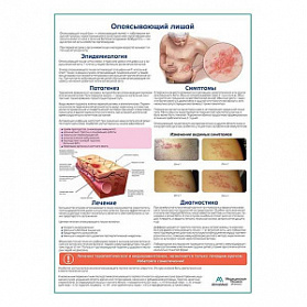 Опоясывающий лишай медицинский плакат А1+/A2+ (глянцевая фотобумага от 200 г/кв.м, размер A2+)