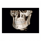 Instrumentarium OP 3D Vision V8 - панорамный томограф