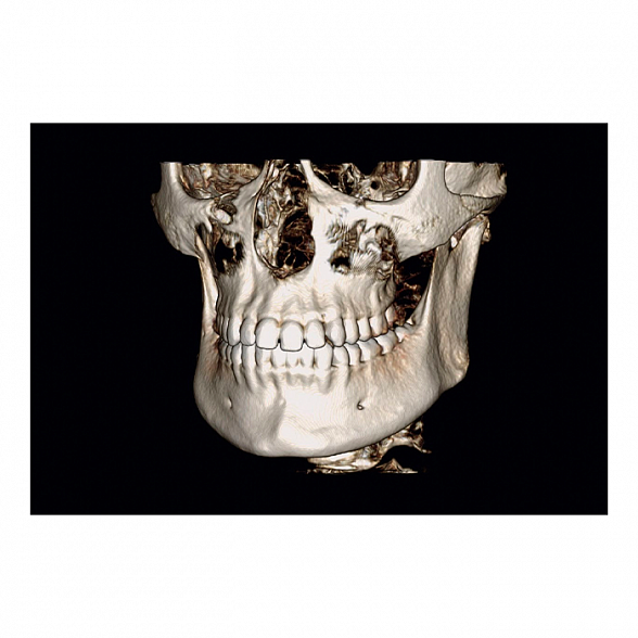 Instrumentarium OP 3D Vision V8 - панорамный томограф