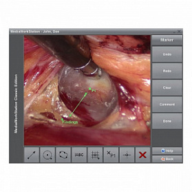 ПО для эндовидеокамер Dantschke MediaWorkStation 2.9 Basic