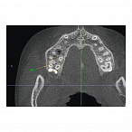 Instrumentarium OP 3D Vision V8 - панорамный томограф