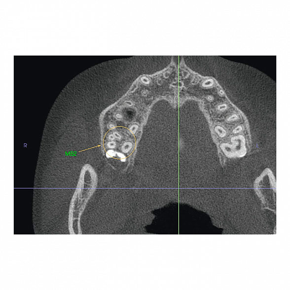 Instrumentarium OP 3D Vision V8 - панорамный томограф