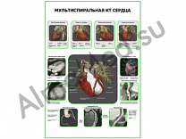 Мультиспиральная КТ Сердца плакат ламинированный А1/А2 (ламинированный	A2)