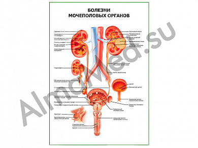 Болезни мочеполовых органов плакат ламинированный А1/А2 (ламинированный A2)