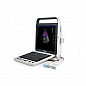 Ультразвуковой сканер S9 SonoScape