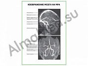 Изображение мозга на МРА плакат ламинированный А1/А2 (ламинированный	A2)