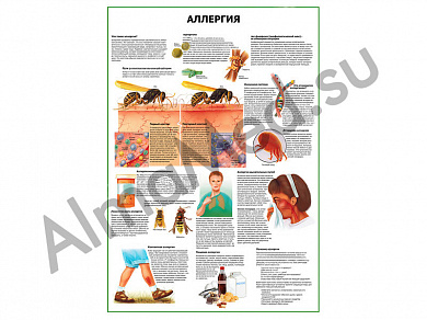 Аллергия плакат глянцевый/ламинированный А1/А2 (глянцевый A2)