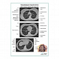 Сканирование грудной клетки плакат глянцевый  А1+/А2+ (глянцевая фотобумага от 200 г/кв.м, размер A1+)