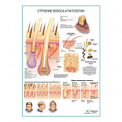 Строение волоса и патологии, плакат глянцевый  А1+/А2+ (глянцевая фотобумага от 200 г/кв.м, размер A1+)